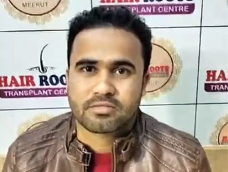 hair roots transplant Meerut2